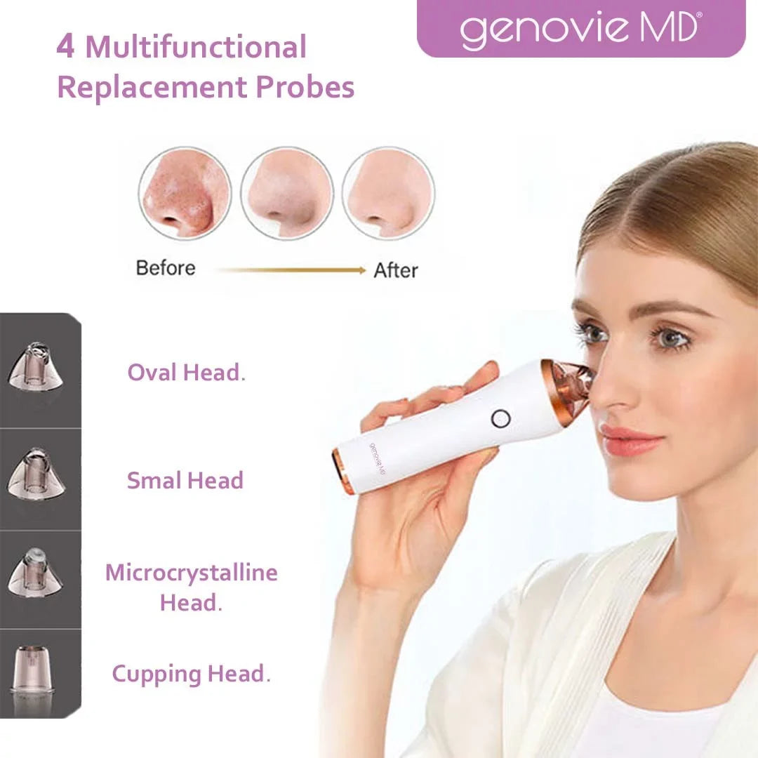 Genovie MD Acne and Deep Pore Cleansing Kit for Face, Acne Remover, Blackhead Remover, Facial Sizekin Treatment, Vacuum Sizeuction